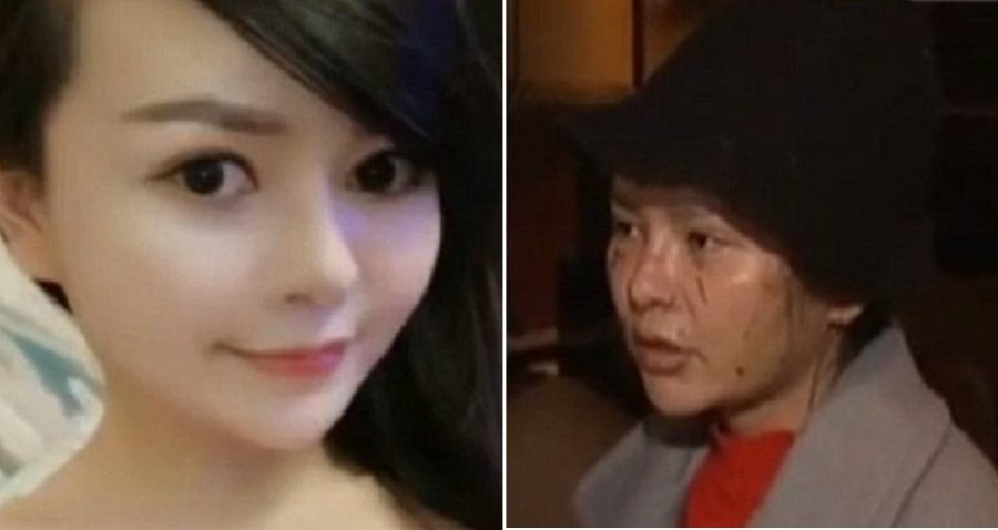 Chinese Woman Claims Her Best Friend Disfigured Her Beautiful Face Out of Jealousy