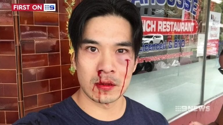 Asian-Australian Model Brutally Assaulted By Road Raging Driver