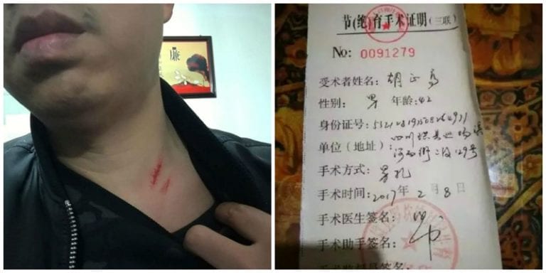Chinese Authorities Allegedly Force Man to Get Vasectomy For Having Too Many Kids