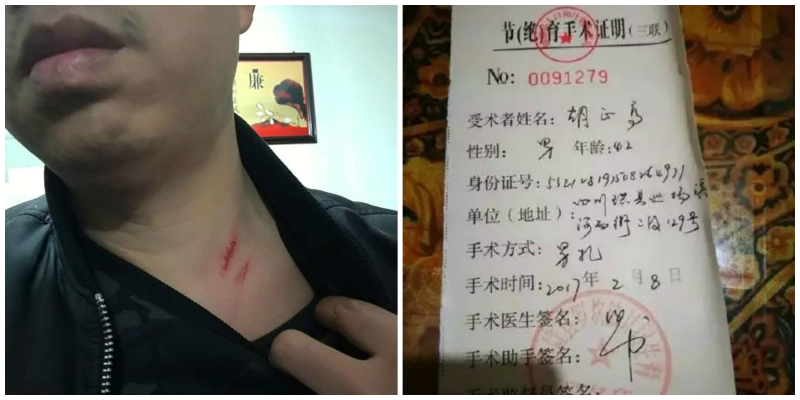 Chinese Authorities Allegedly Force Man to Get Vasectomy For Having Too Many Kids