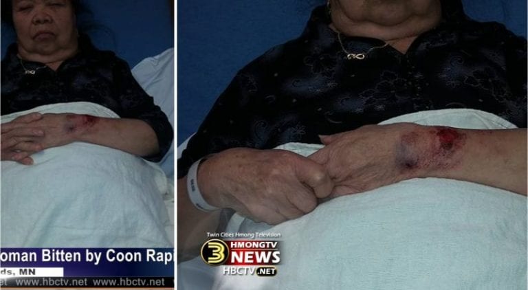 Hmong Community Outraged After Police Dog Brutally Bites 81-Year-Old Grandma