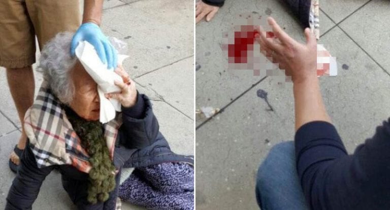 Korean Grandma Allegedly Assaulted by Woman Screaming ‘White Power’ in L.A.