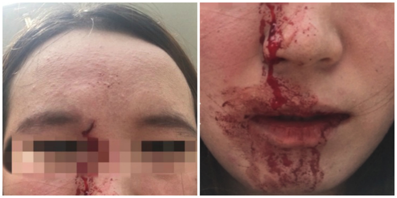 Australian Man Assaults Chinese Woman, Tells Her to ‘Get Out of MY Country’