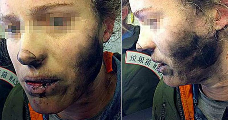 Sleeping Passenger’s Headphone Batteries Explode on Flight from Beijing