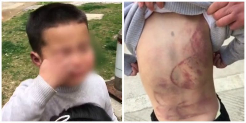 6-Year-Old Chinese Boy Sleeps Under A Car Because His Dad Won’t Stop Beating Him
