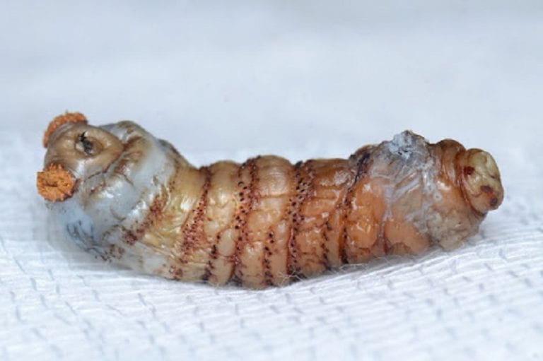 Maggots Burst Out Of Chinese Backpacker’s Leg Weeks After Brazilian Rainforest Trip