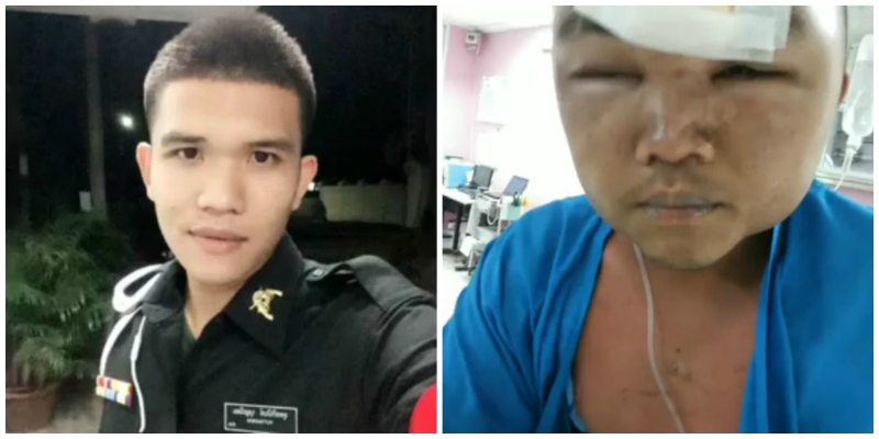 Thai Army Recruit Allegedly Beaten to Death for Waking Up Late