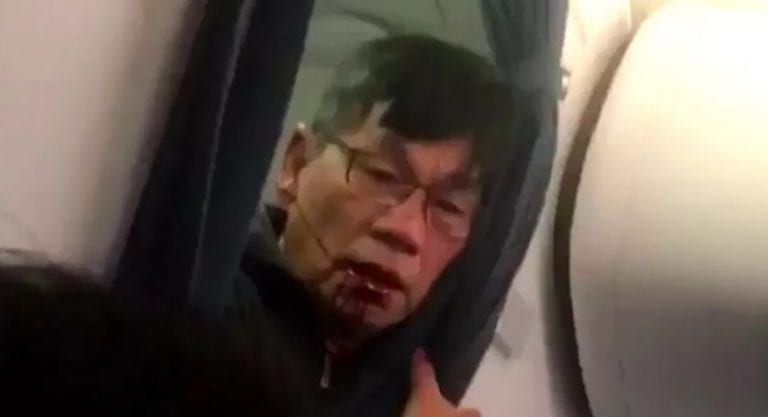 The Settlement Dr. Dao Will Get From United is Expected to Be Enormous