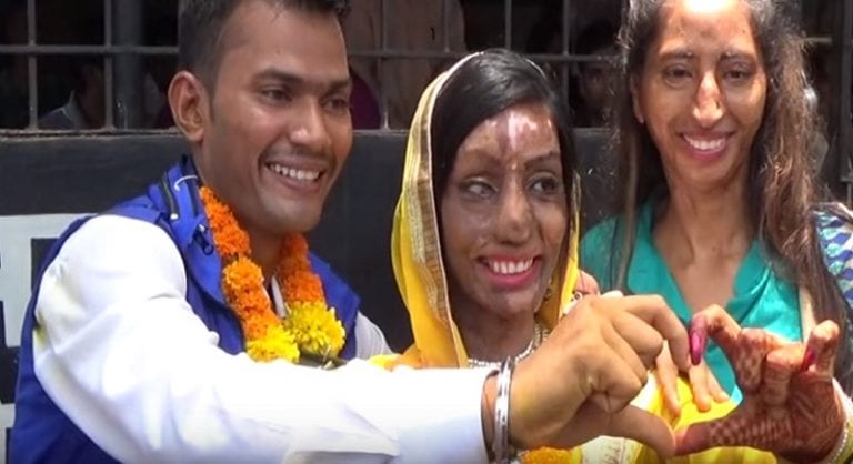 Acid Attack Victim Finds True Love After Dialing the Wrong Number