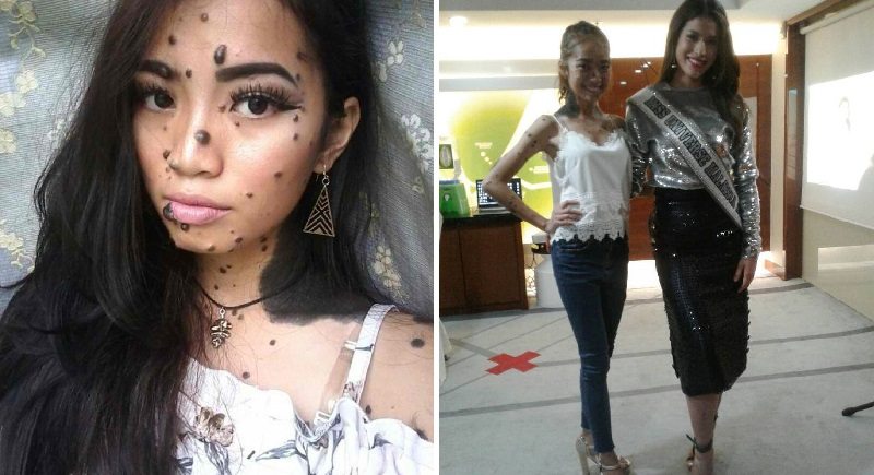 She Was Once Bullied For Her Looks, Now She’s Competing For Miss Universe Malaysia