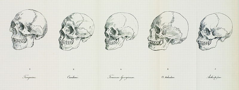 phrenology