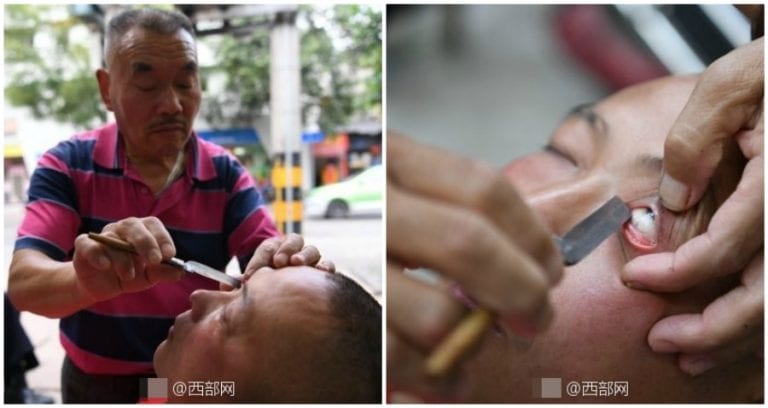 Elderly Chinese Man ‘Cleans’ People’s Eyes With a Sharp Razor Blade