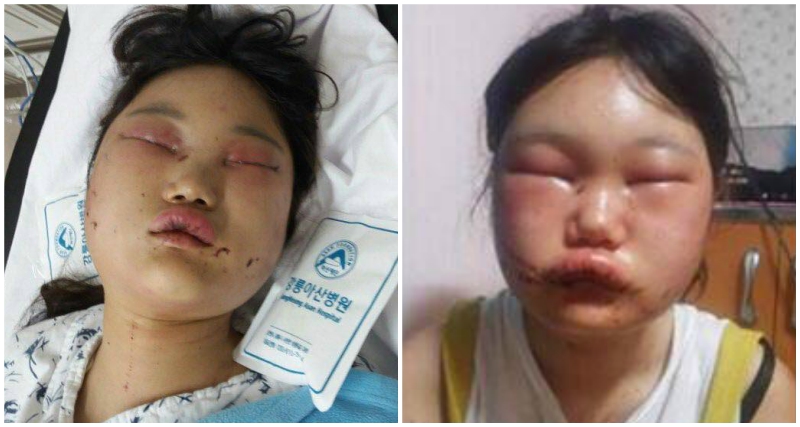 Another Korean Girl Viciously Beaten, Sexually Harassed By School Bullies in Viral Incident