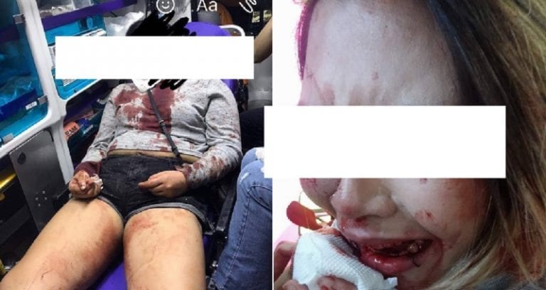 Indonesian Woman Allegedly Attacked By South Korean Club Bouncer Because of Her Race