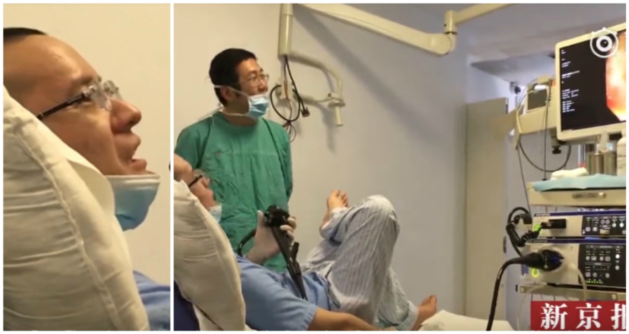 Chinese Doctor Performs Colonoscopy on Himself to See How Crappy it is For Patients
