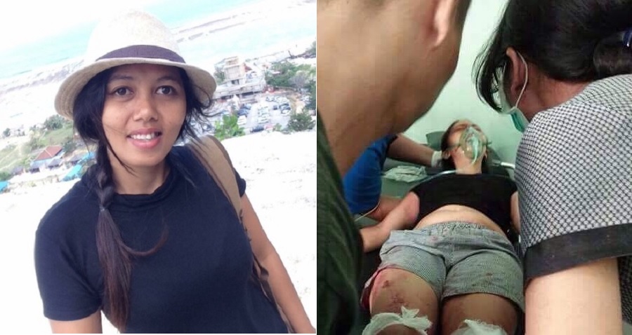 Man in Indonesia Chops Wife’s Foot Off in Front of Children After Suspecting an Affair