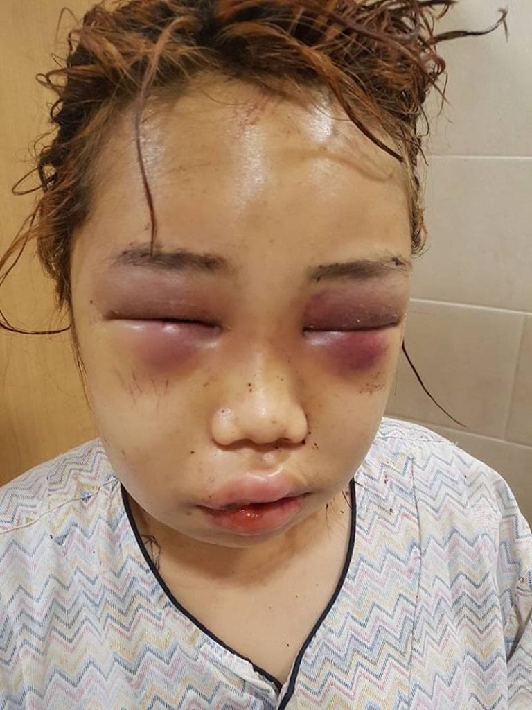 South Korean Teen Is Brutally Beaten By Bullies After Police Ignore Her