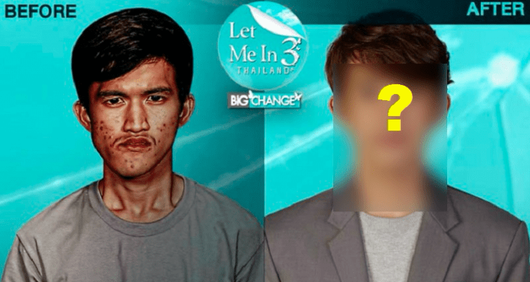 Thai Makeover Show Gives Man With Disfigured Jaw the Most Epic Transformation