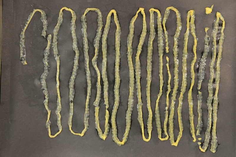 singapore-tapeworm