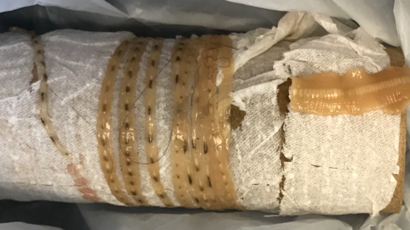 five-foot japanese salmon tapeworm
