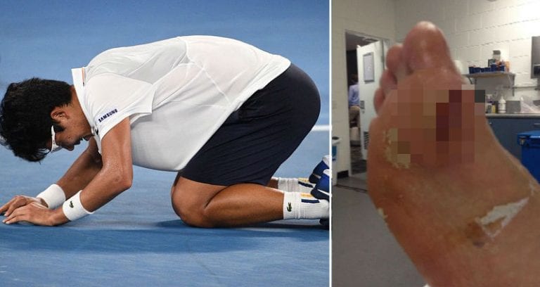 Blister Forces Tennis Star Hyeon Chung to Forfeit the Australian Open