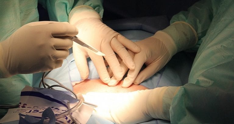 Woman Sues Japan For $101,000 After Forcing Her to Undergo Sterilization as a Teen