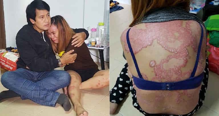 Thai Woman With Psoriasis Loses Her Husband and Job Over Fears She Has AIDS