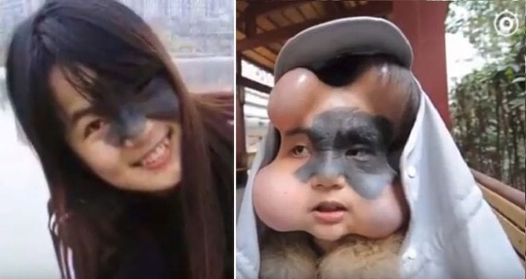 Brave Chinese Woman Gets Balloons Implanted in Face to Help Remove Dangerous Birthmark
