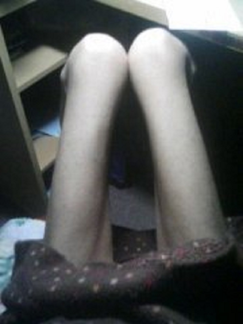 anorexia
