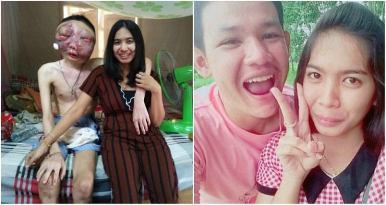 She Stays With Him as Deadly Eye Cancer Spreads All Over His Face