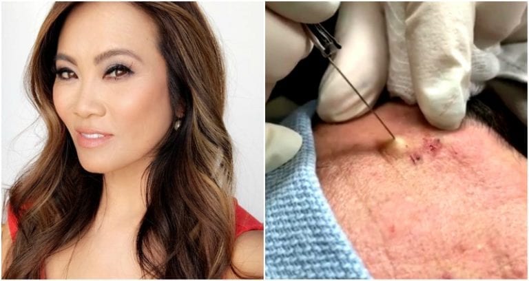 Dr. Pimple Popper is Getting Her Own Reality Series on TLC