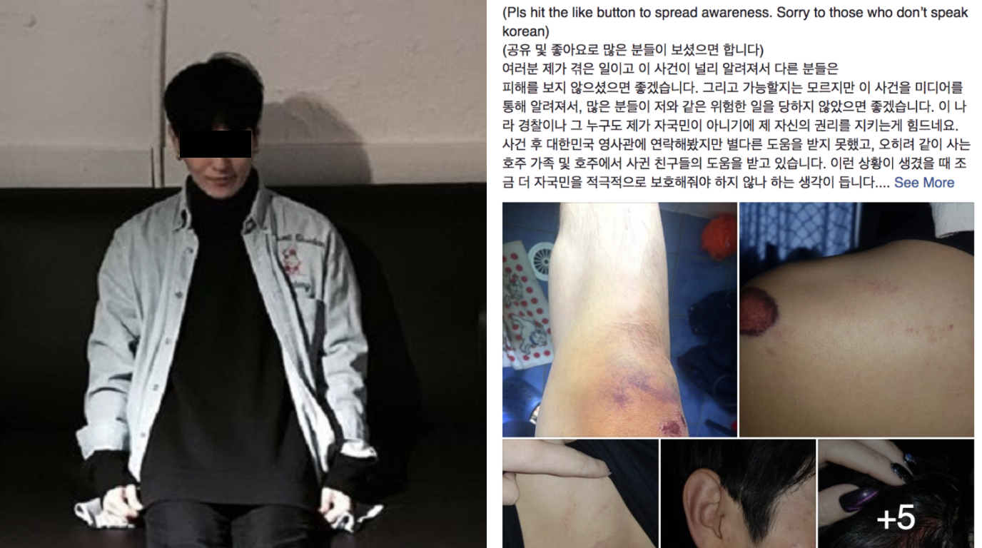 Korean Student Beaten By Drunk Man For Being Asian in Australia