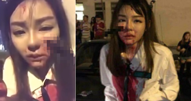 Brutal Robbery Leaves Teen In Malaysia With Knife Stuck In Her Face