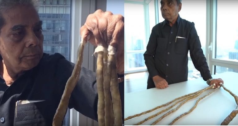 Man With The World’s Longest Fingernails Finally Decides To Trim Them After 66 Years