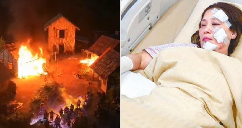 31 Actors Suffer Terrible Burns After Movie Stunt Goes Wrong in Malaysia