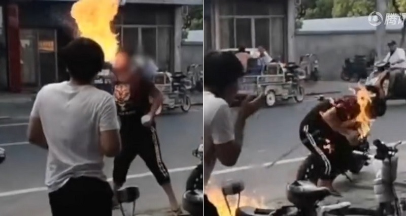 Teen Accidentally Sets His Face on Fire After Trying to Impress His Friends
