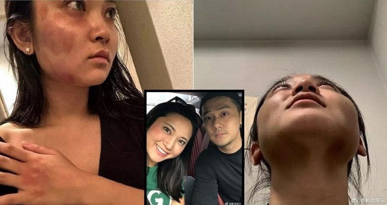Chinese Celebrity Admits to A‌b‌‌u‌s‌i‌n‌g Model Girlfriend After Photos Surface Online