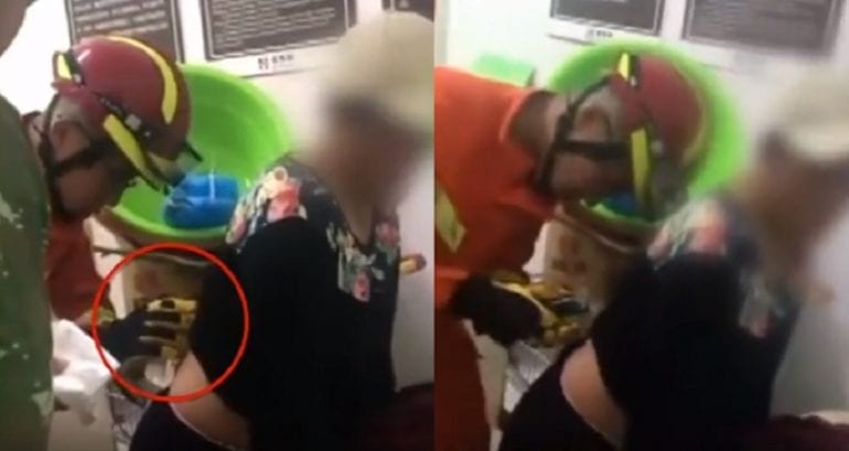 Woman Performs Cupping Therapy on Herself, Fails Miserably