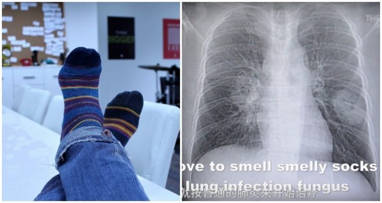 Chinese Man Obsessed With Sniffing His Socks After Work Gets Fungal Infection in His Lungs