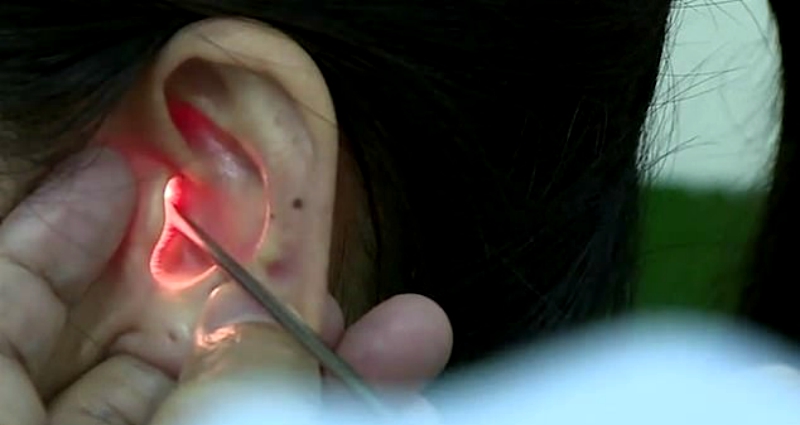 A woman in southeastern China had a waking nightmare when she realized she can no longer hear men’s voices.