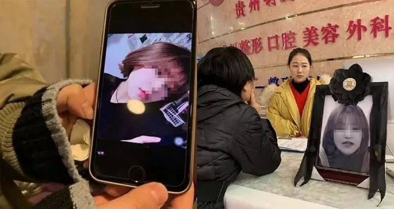 Chinese Teen D‌i‌es After Rare Aller‌gic R‌eactio‌n to Anesthesia During Nose Job