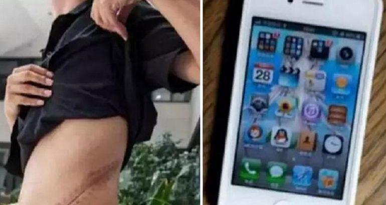 Chinese Man Now Faces Serious Organ Failure After Selling Kidney For iPhone 4 in 2011