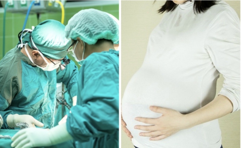 Chinese Woman Who Had 17 A‌b‌‌o‌rt‌‌i‌o‌‌n‌s in 6 Years May Never Be Able to Have Children Again