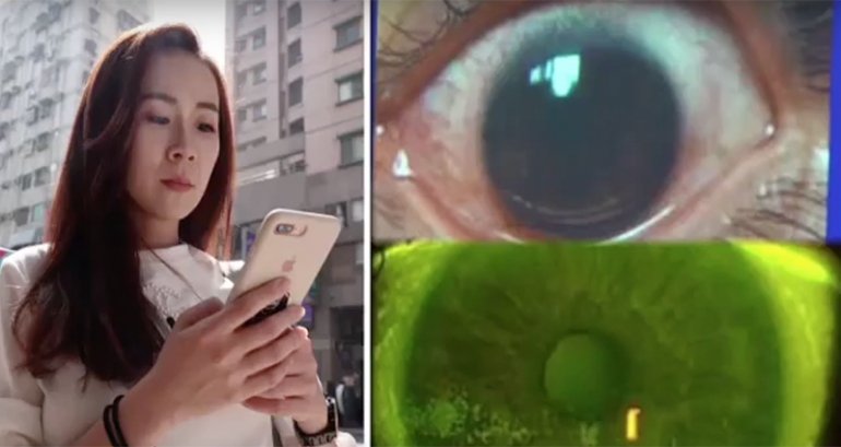 Taiwanese Woman B‌u‌r‌ns 500 Holes in Her Eyes After Using Phone on Max Brightness For Two Years