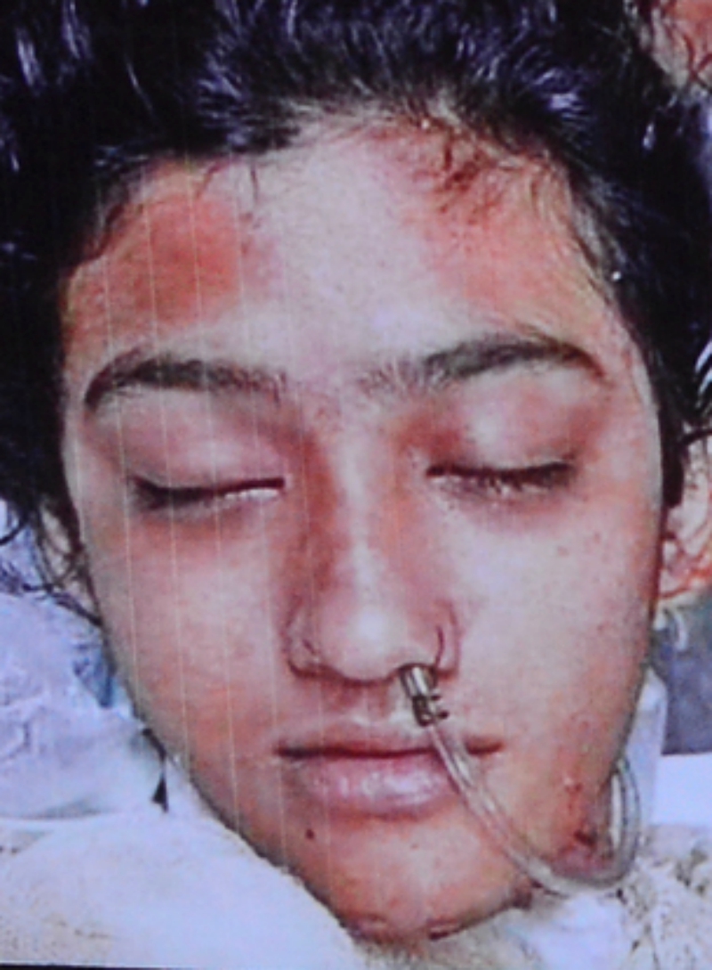 A female student at an Islamic school in Feni, Bangladesh has died days after unidentified individuals set her on fire in apparent retaliation for a sexual harassment report she had made against the school principal.