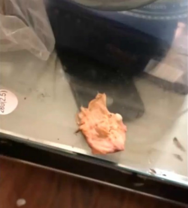A woman in southeastern China allegedly sneezed out some cotton left over from a nose job that she had undergone half a year ago.