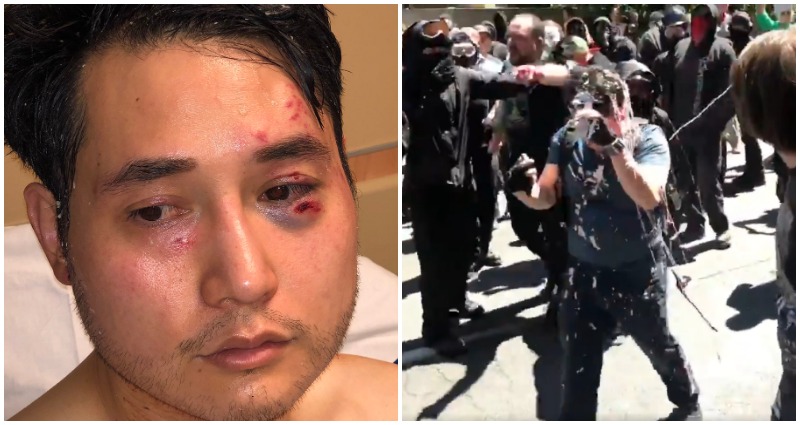 Conservative Journalist Suffers ‘Brain Bleed’ After Attack at Protest