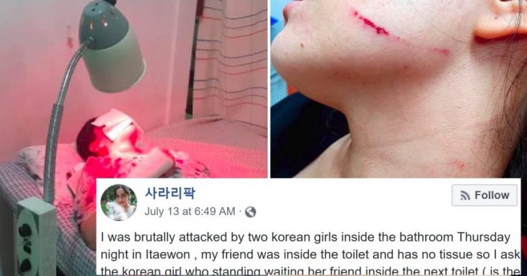 Swedish Woman Claims Korean Girls Brutally Beat Her After Asking Them For a Tissue