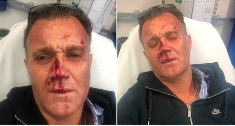 Man Brutally Beaten for Defending Asian Boy From ‘Racist Attack’