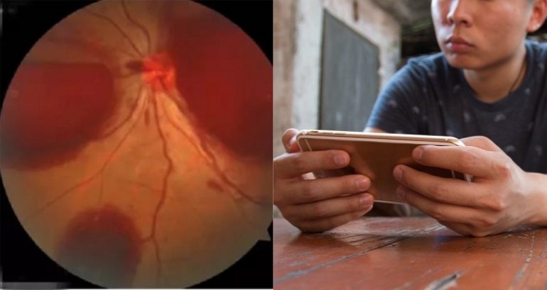Man Loses Eyesight After Playing Mobile Games All Night